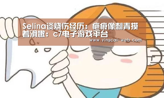 Selina谈烧伤经历:疤痕像刺青摸着滑嫩:c7电子游戏平台(图1) c7电子游戏平台