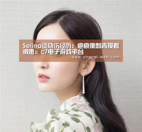 Selina谈烧伤经历:疤痕像刺青摸着滑嫩:c7电子游戏平台(图2) c7电子娱乐